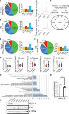 METTL3-Mediated N6-Methyladenosine Modification Is Involved in the Dysregulation of NRIP1 Expression in Down Syndrome